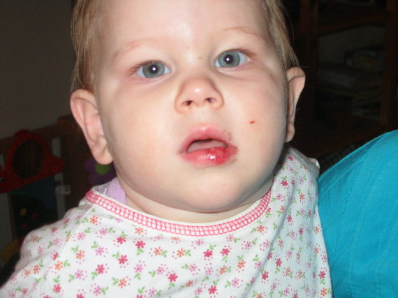 Weer een eerste keer: Eerste echte tand door de lip